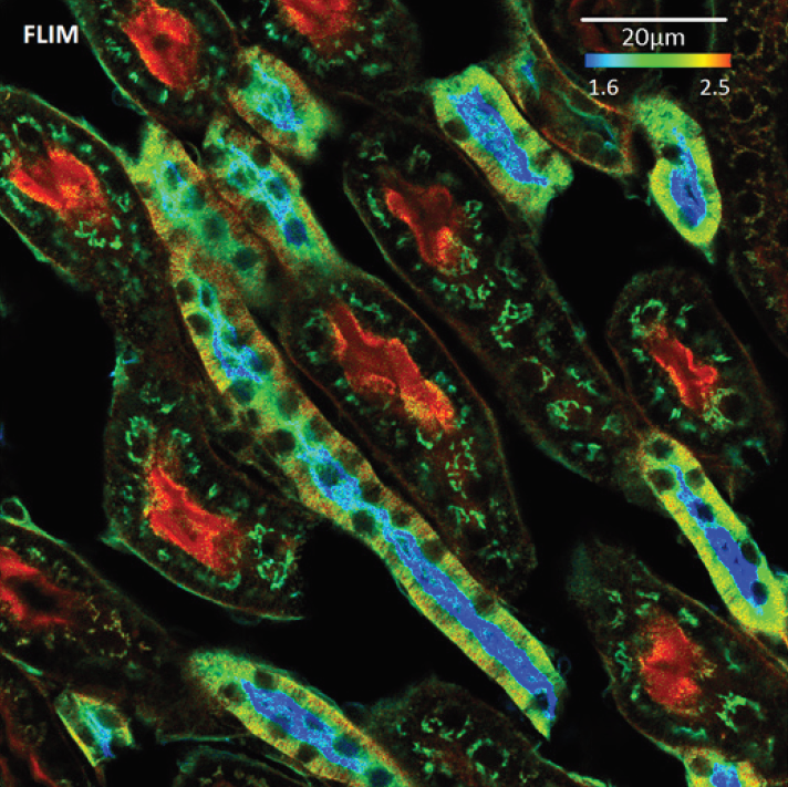 Special workshop: fast FLIM and its revolutionary applications